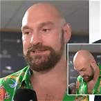 bet tyson fury